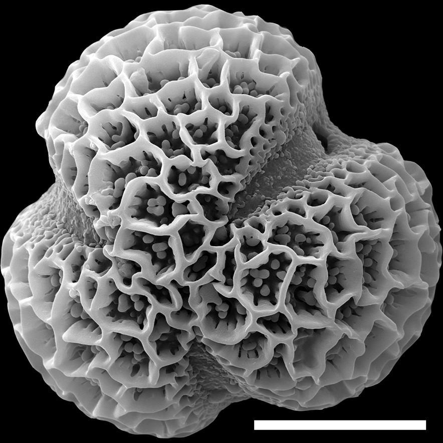 Magnified image of a pollen grain